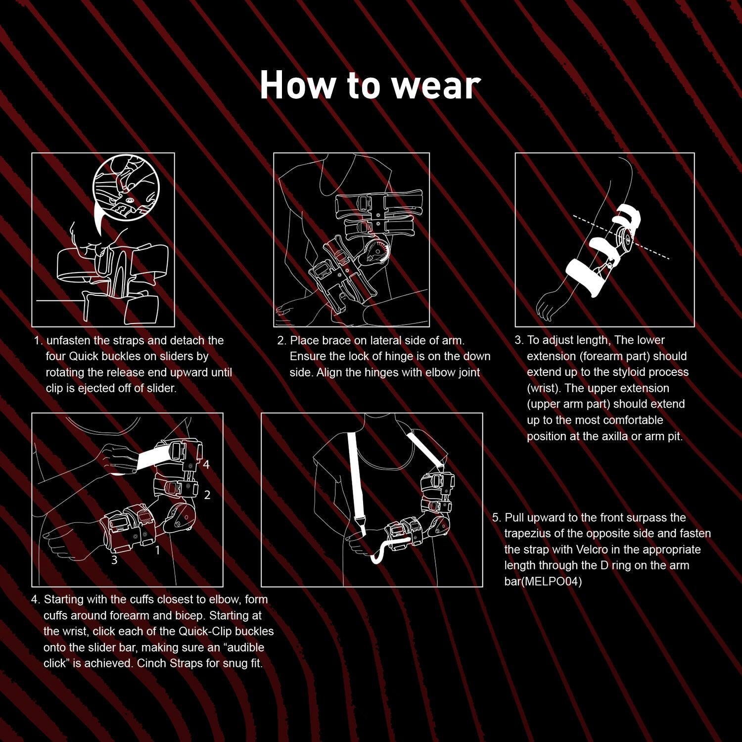Zoyer Recovery+ Zero Gravity Post-OP Elbow Brace w/ Hand Grip