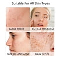 thumbnail image 4 of Cepillo limpiador facial de silicona VWMYQ negro+blanco, 4 of 9