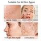 thumbnail image 4 of Cepillo limpiador facial de silicona VWMYQ negro+blanco, 4 of 9