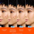 thumbnail image 5 of Biore Paint & Peel Liquid Pimple Patch with Salicylic Acid, up to 100 Uses, .5 oz, 5 of 14