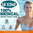 thumbnail image 2 of Cinta de silicona Arme para cicatrices, láminas de silicona de 4 x 61 cm (2 rollos de 6 m), láminas de grado médico para eliminar cicatrices quirúrgicas, tiras reutilizables para abdominoplastia, cesá, 2 of 7