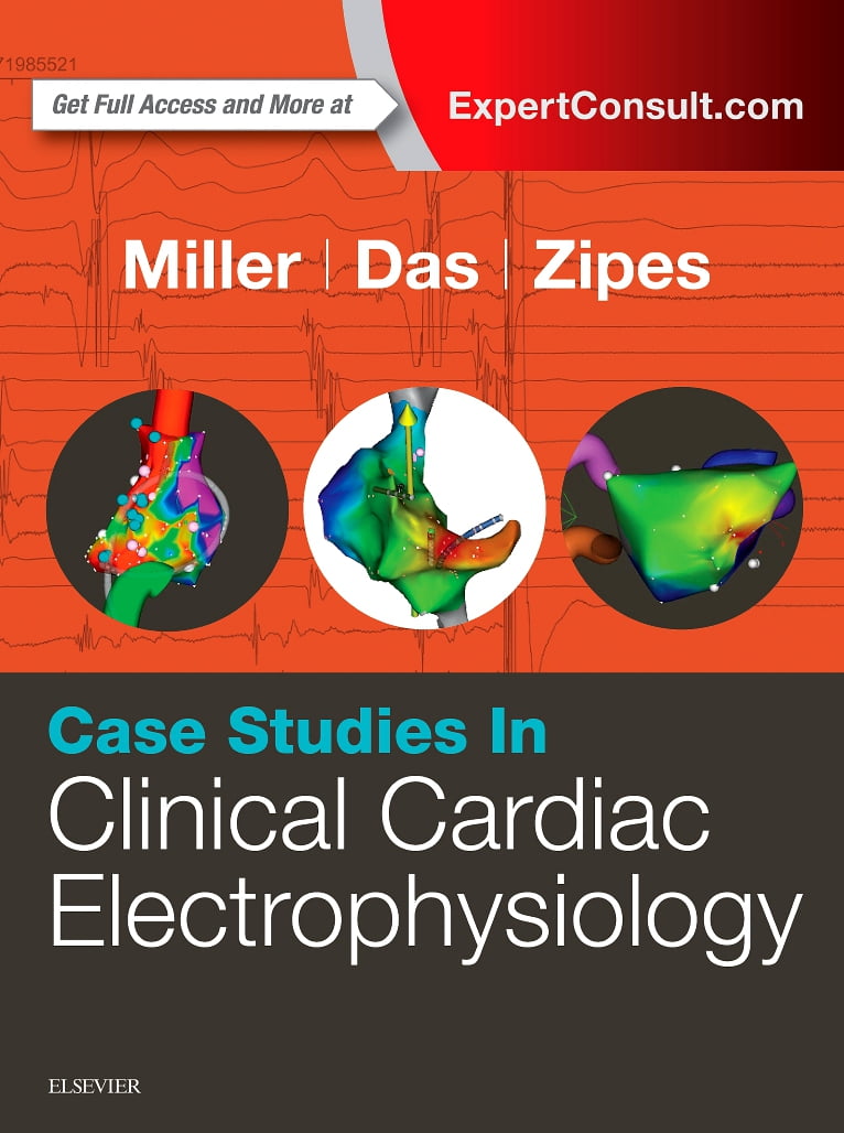 健康・医学 Perioperative Cardiac Anesthesia&Surgery Clinical Perfusion for Cardiac Surgery: A Step-by-Step Guide