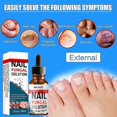 thumbnail image 2 of 3PCS Nail Repair Solution Hand & Foot Grey Nail Care Repair Grey Nail Solution, 2 of 4