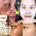 thumbnail image 1 of Suero blanqueador con vitamina C Elimina las pecas Manchas oscuras Esencia facial Atenúa el melasma Melanina Ilumina Repara la piel opaca Cuidado Cosméticos, 1 of 6