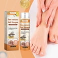 thumbnail image 2 of Houkea Bee Venom Nail Repair Spray Daily Nail Repair Natural Gloss Gentle Nourishing Spray, 2 of 5