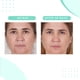 thumbnail image 4 of Mascarilla facial Serious Skincare Glycolic Gommage Extreme 130 ml, 4 of 7