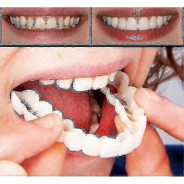 A Pair Upper Lower High Quality Denture Instant Smile Comfort Fit Flex Cosmetic Teeth Denture Teeth Top Cosmetic Veneer High Quality