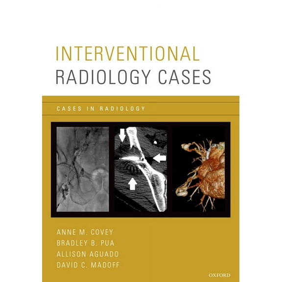 Cases in Radiology Interventional Radiology Cases, (Paperback)