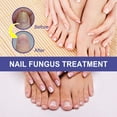 Nails Kits Nail Solution And Thicken Nails Soft Nail Polish Nail Care