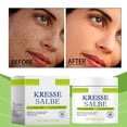 thumbnail image 4 of Crema de Levadura Calmante Natural para la Piel con Aloe Vera y Extracto de Ginkgo Biloba para el rostro - Tratamiento Hidratante Diario para Pieles Secas - Fórmula Suave y No Pegajosa para Hombres, 4 of 7
