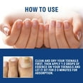 thumbnail image 5 of Nail Care Solution For Cleaning Hands Feet Gray Nails Rotten Nails Thickened Yellow Nails Soft Nails Bright Nails And Nail 20ml Mini Files for Nails 100/180, 5 of 9