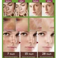 thumbnail image 4 of Crema blanqueadora para pecas, eliminador de Melasma y puntos negros, antimanchas marrones, aclara la pigmentación, hidratante, productos coreanos para el cuidado de la piel, 4 of 5