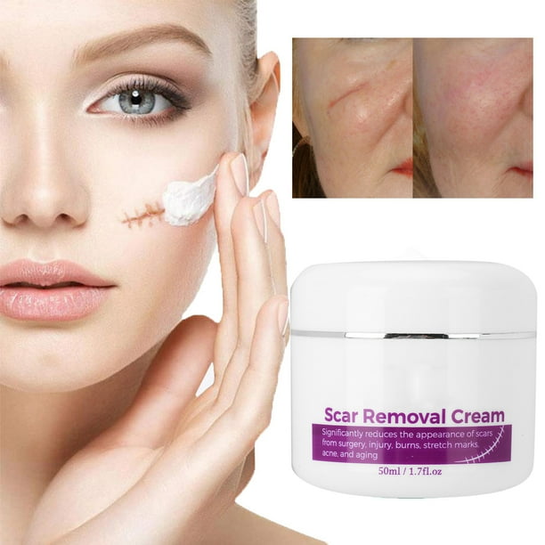 Scar Removal Cream, Scar Removal Cream, Skin Repair Treatment For Stretch  Marks Burn Scars Incision Scars Operation Scars