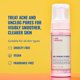 thumbnail image 2 of Espuma antiacné Cleanser Good Molecules con ácido salicílico, 148 ml, 2 of 7