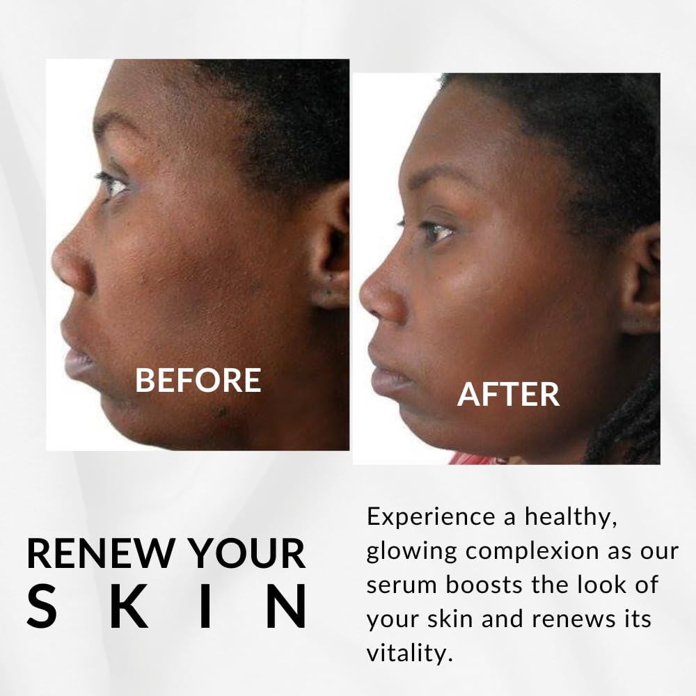 Flori Roberts Moisture Serum, Reduces Appearance of Dark Spots, Lines and Wrinkles, Serum for Women