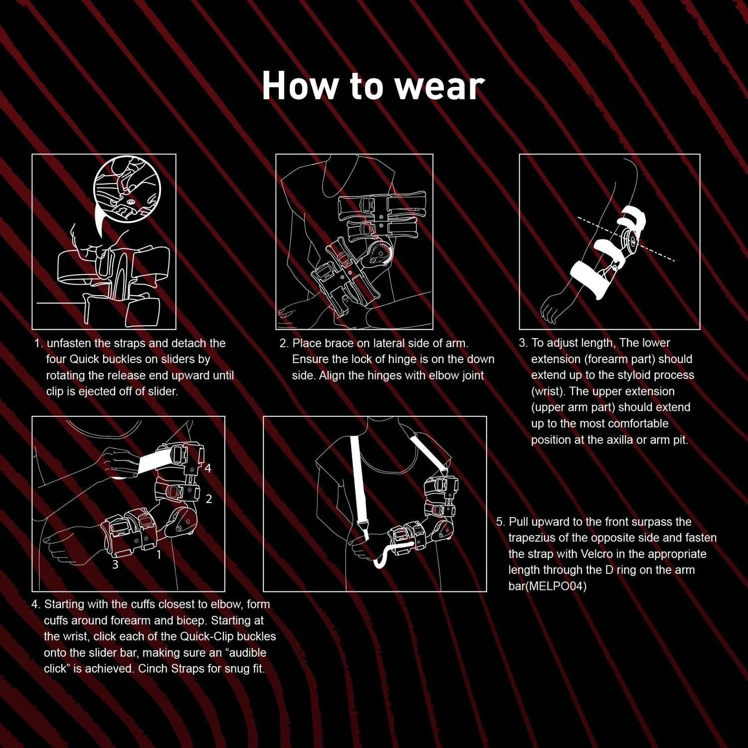 Zoyer Recovery+ Zero Gravity Post-OP Elbow Brace w/ Hand Grip