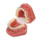 thumbnail image 4 of Modelo de ortodoncia dental de 28 piezas, resina dental, modelo de enseñanza dental con brackets metálicos., 4 of 14