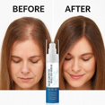 thumbnail image 5 of 3X Hair Growth Serum Roll On with Rosemary Nourishing Scalp Hair Treatment Promotes Growth Reduces Hair Loss 25ML, 5 of 5