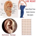thumbnail image 2 of Auriculotherapy Patch Acupuncture Ear 300pcs Auricular Seed Other, 2 of 8