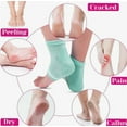 thumbnail image 4 of Moisturizing Gel Heel Socks for Dry Cracked Feet, Shynek 3 Pairs Spa Socks Lotion Toeless Socks for Women Dry Cracked Heel Feet Repair, Foot Care (Grey, Pink, Blue), 4 of 5