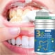 thumbnail image 5 of Limpieza dental Eliminación de manchas dentales Polvo de limpieza bucal fresco 50 g Limpieza dental, 5 of 5