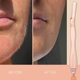thumbnail image 5 of Herramienta de dermaplanamiento Brandluxe Dermaplaner con 3 cuchillas RoseGold, 5 of 9