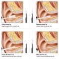 thumbnail image 4 of Digital Otoscope Camera Ultra Clear View 6 LED Lights IP67 Waterproof Ear Scope Endoscope for Android OTG Black 5.5mm, 4 of 8