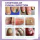 thumbnail image 2 of Jaysuing Gray Nail Repair Spray Hand And Foot Nail Soft Nail Yellow Endogenous Nail Thickening Cleaning Care - 100ml, 2 of 5