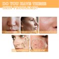 thumbnail image 3 of Skin Repair Facial Toner, Reduce Pigmentation 3pcs 100ml Hydrating Face Toner  For Daily Use, 3 of 8