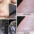 thumbnail image 1 of 10Pcs Deep Cleaning Nose Pore Strips for Blackhead Removal Blackhead Remover Nose Strip Sticker, 1 of 8