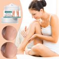 thumbnail image 2 of Vova Crema Varices 30ml, 2 of 5