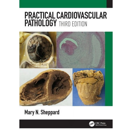 UPC: 9781498787550 | Practical Cardiovascular Pathology (Paperback)