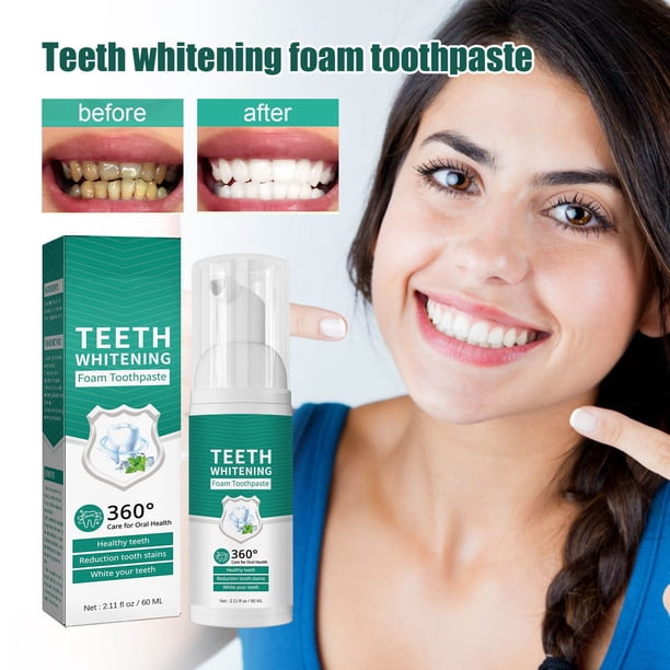 Pasta de dientes para limpieza dental Oral Para limpiar manchas Para limpiar manchas Para limpiar dientes amarillos Aliento fresco y brillante 60 ml dientes frescos
