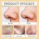thumbnail image 3 of OUHOE Enzymes Exfoliating Brightening Gel, Gentle Exfoliating Cleansing Gel Deeply Purifies Pores, Removes Blackheads And Brightens Skin, 3 of 5