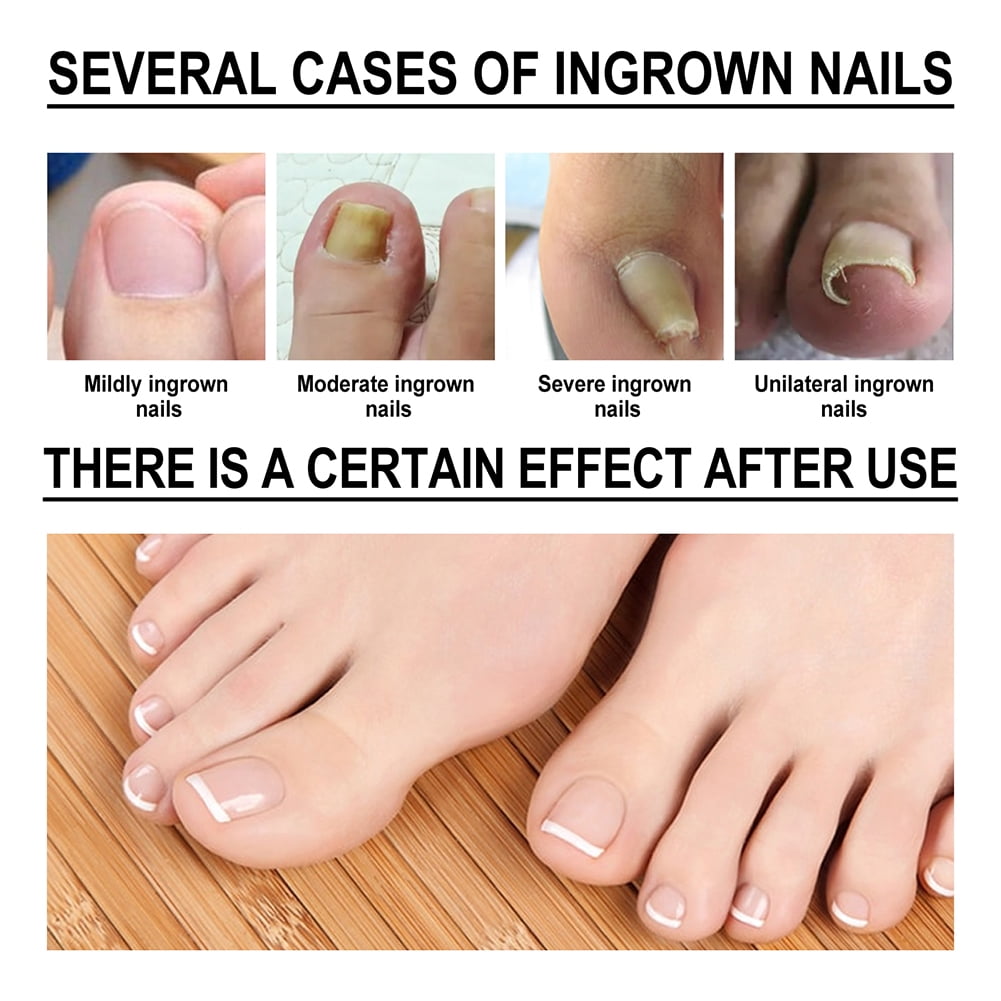 Walk Away from Foot Pain with Texas Spine and Sports Therapy Center