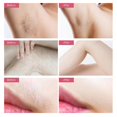 thumbnail image 4 of Laser Hair Removal Instrument Household Hair Removal Apparatus Ipl Intense Pulsed Light Electric Laser Epilator Device, 4 of 4