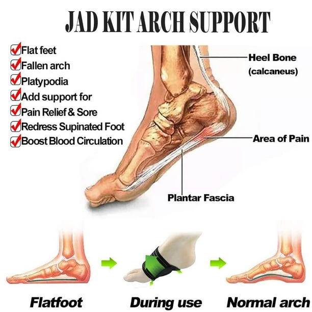 Foot support for store flat feet