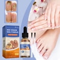thumbnail image 1 of Solución extrafuerte para hongos en las uñas de los pies y las manos, líquido para uñas gruesas, agrietadas y descoloridas, salud de las uñas 50 ml, 1 of 5
