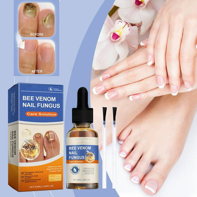 Solución extrafuerte para hongos en las uñas de los pies y las manos, líquido para uñas gruesas, agrietadas y descoloridas, salud de las uñas 50 ml