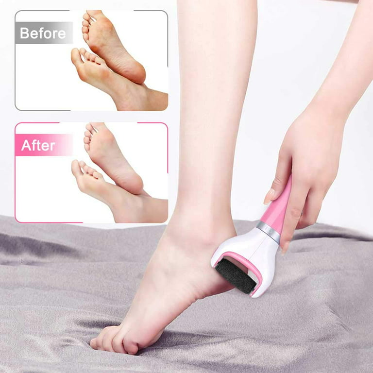 Foot Scrubber Electric Callus Remover for Feet, Portable Electronic Foot  File Pedicure Tool, Foot Scraper Professionally Remove Dead Skin  Exfoliator, Hard Cracked Dry Skin Ideal Gift(Pink) 