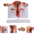 thumbnail image 5 of Pathological Uterus Ovary Model, Female Reproductive Organ Model Human Uterus Anatomical Model with Educational Display Card and Base, for Teaching Learning, 5 of 8