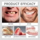 thumbnail image 5 of Premium Denture Set, Advanced Silicone Reline Denture Set Cosmetic Teeth Veneers for Perfect Smile, 5 of 5
