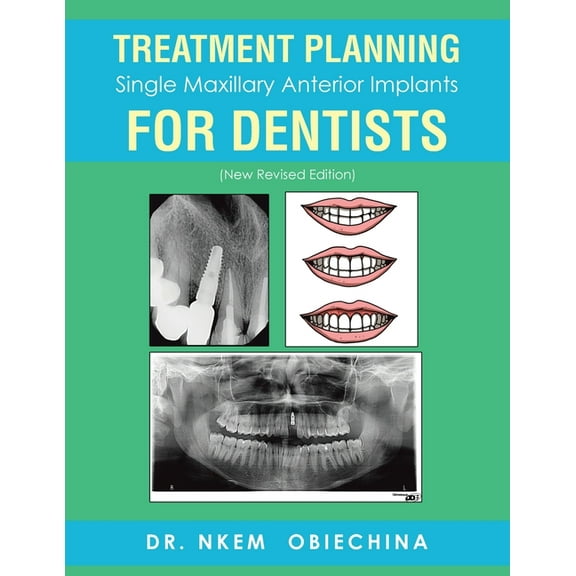 Treatment Planning Single Maxillary Anterior Implants for Dentists (Paperback)