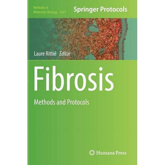Methods in Molecular Biology Fibrosis: Methods and Protocols, Book 1627, (Hardcover)