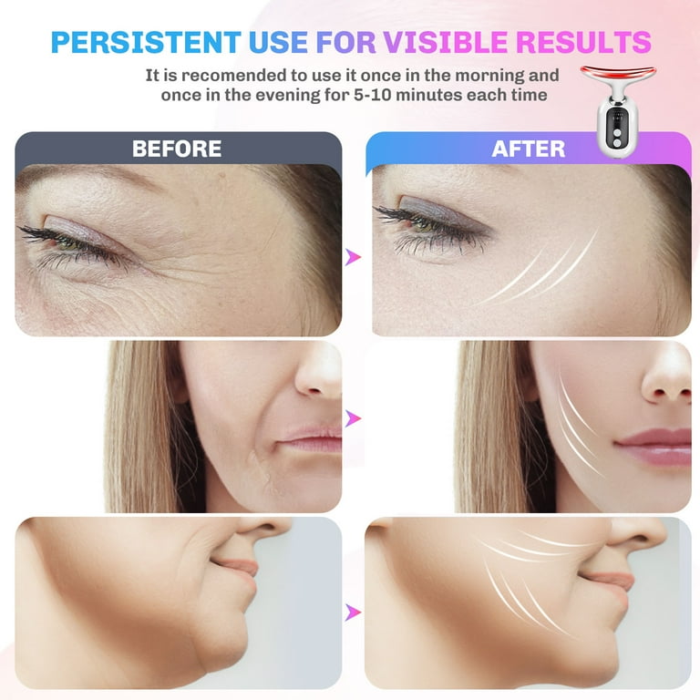 Facial Lifter Toning Anti-Aging System: Wrinkle Removal for