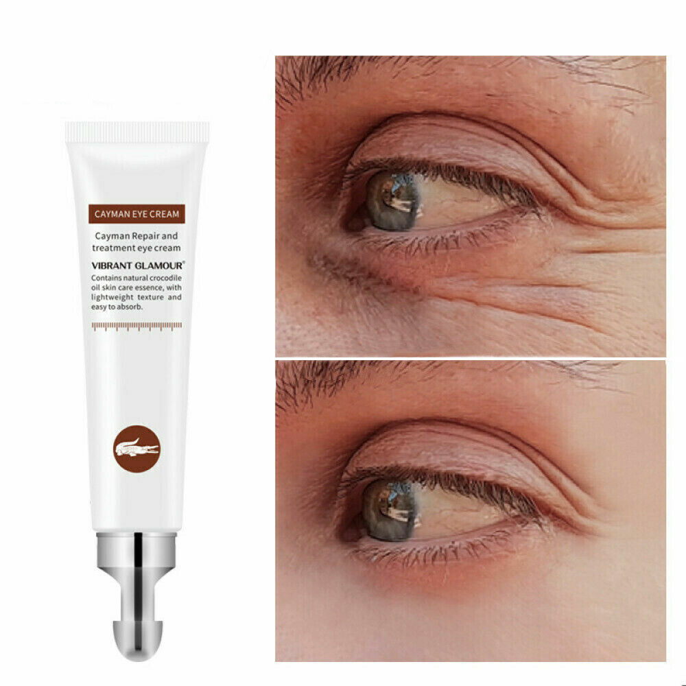 AntiWrinkle Eye Cream, 2Pcs AntiAging Rapid Reduction Eye Cream