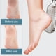 thumbnail image 3 of Lima para pies, exfoliante de pies desmontable de acero inoxidable, removedor de durezas para pies húmedos y secos, color rosa, 3 of 5