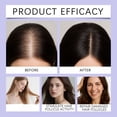 thumbnail image 5 of SZBAOAN Hair Care Ampoule With Brush,Anti-Hair Loss for Men & Women,Scalp Care to Support Thicker & Healthier Hair for Women and Men, 5 of 8