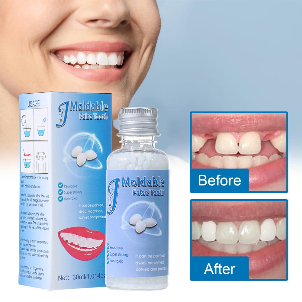 Hiroke Teeth Repair Kit, Temporary False Teeth Moldable False Teeth for Snap on Instant and Confident Smile 2pcs, Adult Unisex