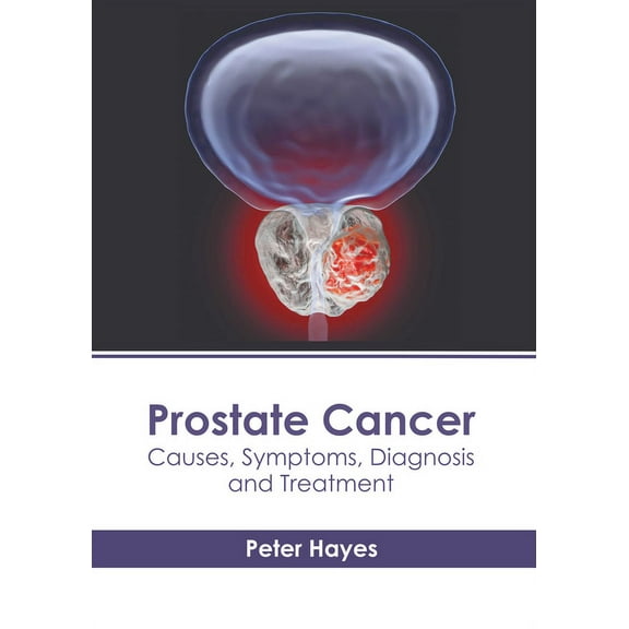 Prostate Cancer: Causes, Symptoms, Diagnosis and Treatment, (Hardcover)